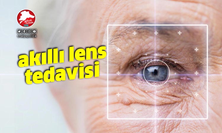 Akıllı lens tedavisi ile gözlüklere veda edin