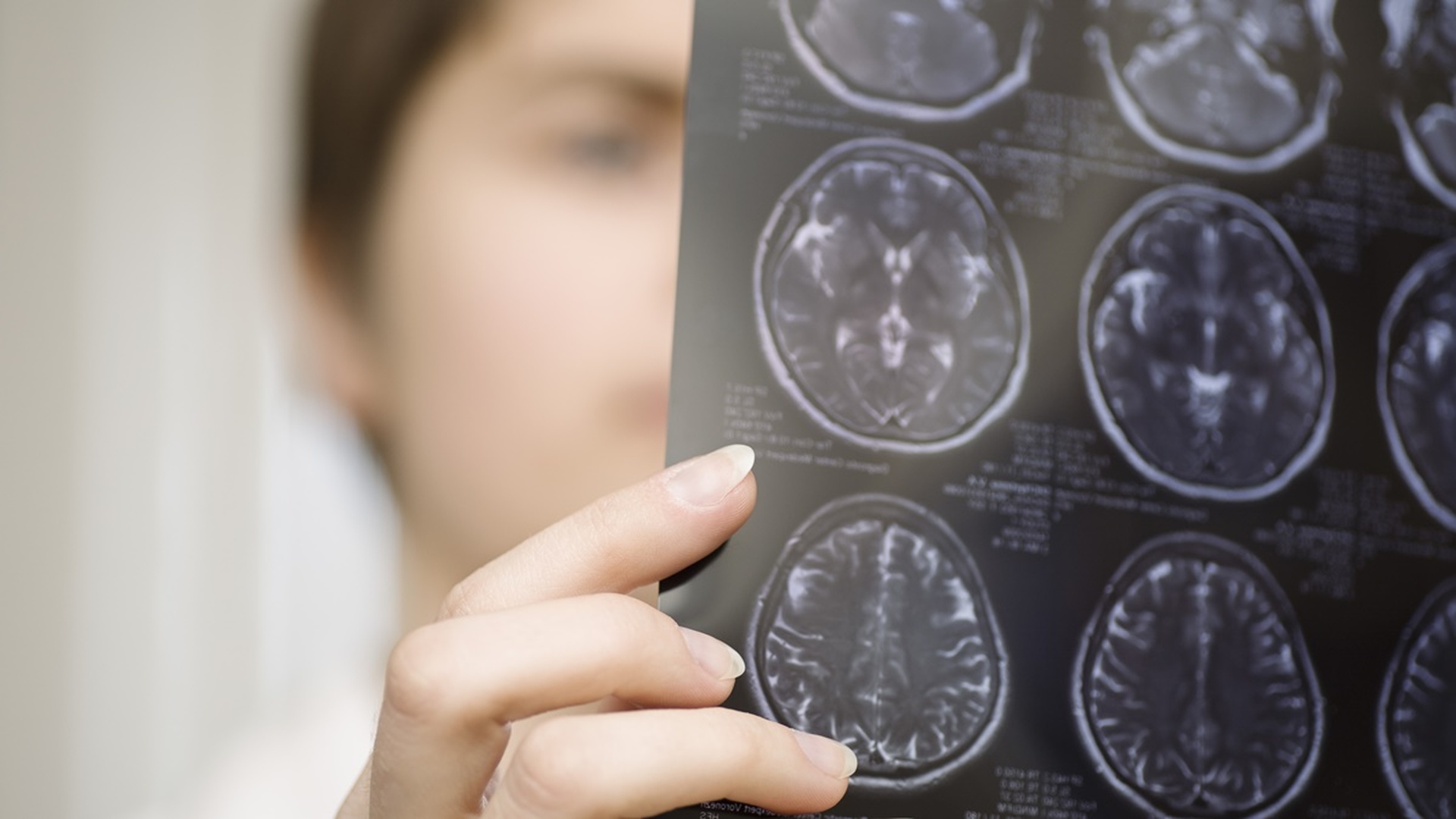 Beyin tümörü tanı ve tedavi yöntemleri
