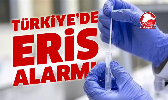 Türkiye’de Eris alarmı